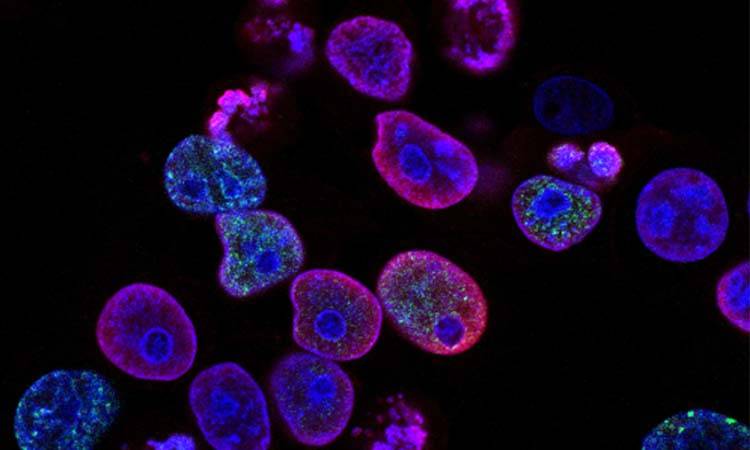 Pakistan’s First Ever Cancer Research Lab Established At LUMHS