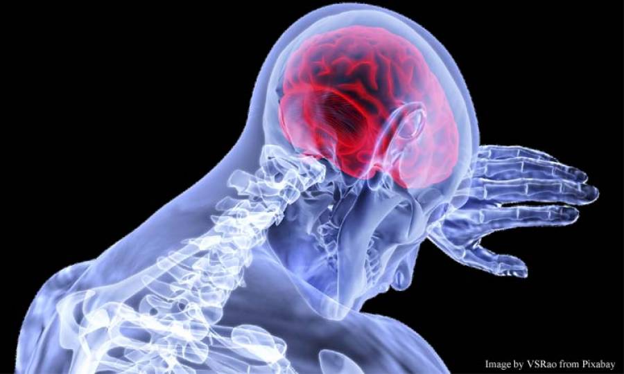 Stroke Second Leading Cause Of Death Worldwide: Experts 