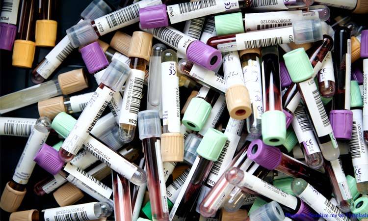 KPK decides to outsource its regional blood centres
