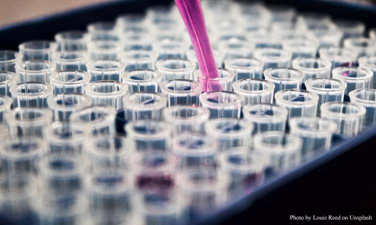 Cancer prevalence and its chemotherapeutic measures in Pakistan