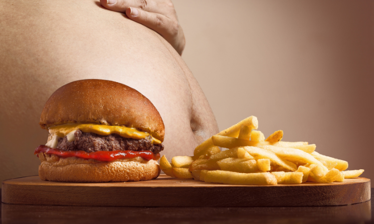 Obese patients are increasing in Pakistan: Shahid Rasul