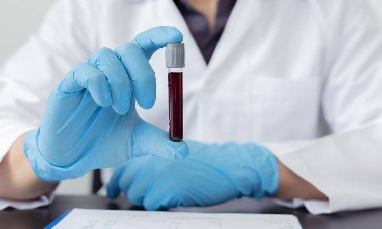 Deep Vein Thrombosis: Causes & Cures