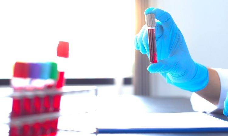 Pakistan is facing increased incidence of Aplastic Anemia: Experts