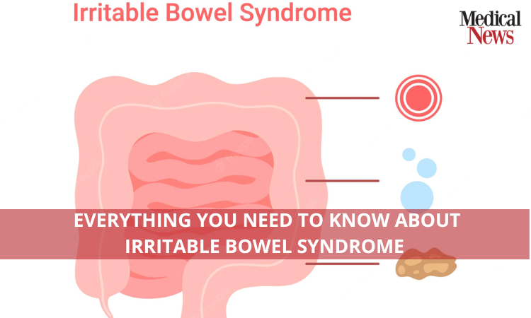 Everything you need to know about Irritable Bowel Syndrome