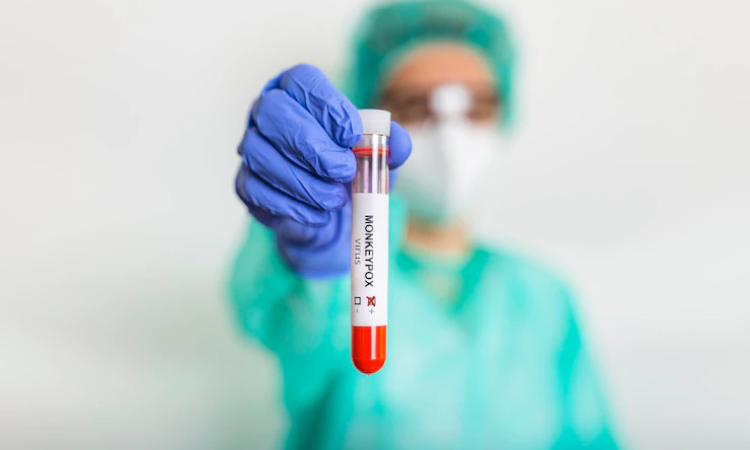 Monkeypox - High risk individuals identified