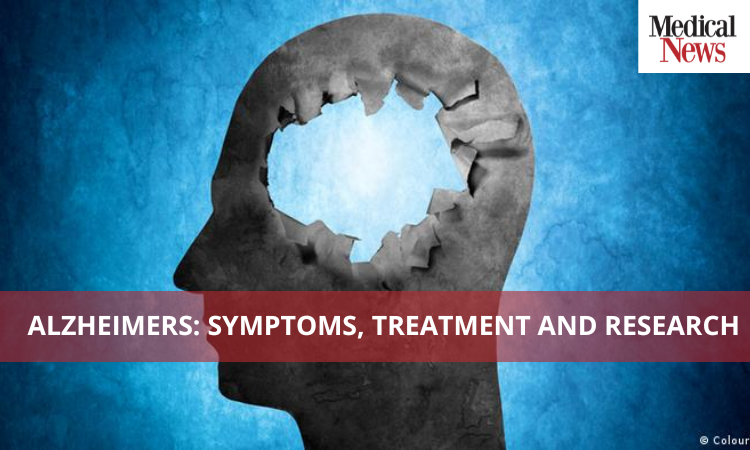 Alzheimer's: Symptoms, treatment, and research