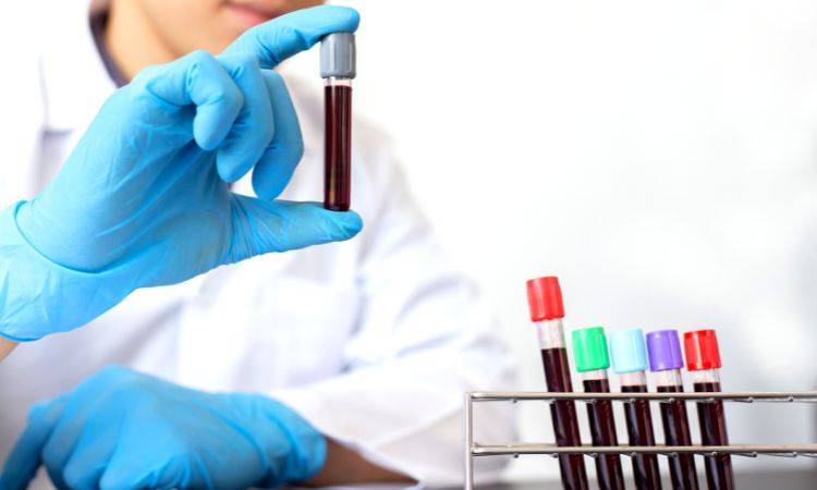Sindh Healthcare Commission reduces charges for Dengue, Malaria tests