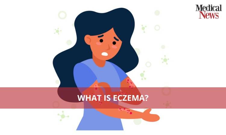 What is Eczema?