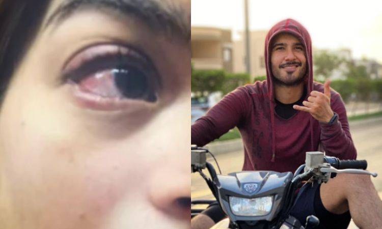 Pictures of alleged domestic violence against actor Feroze Khan