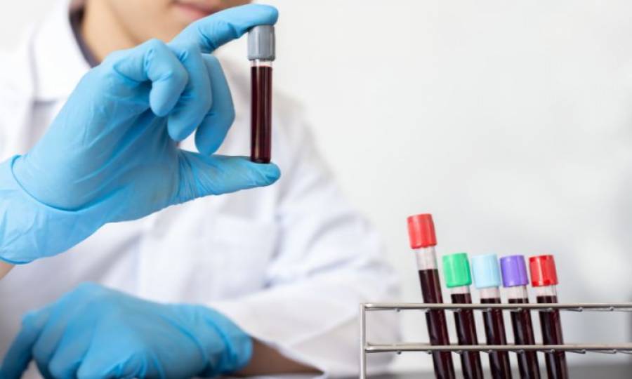 JSMU Laboratory launches test to diagnose H. Pylori