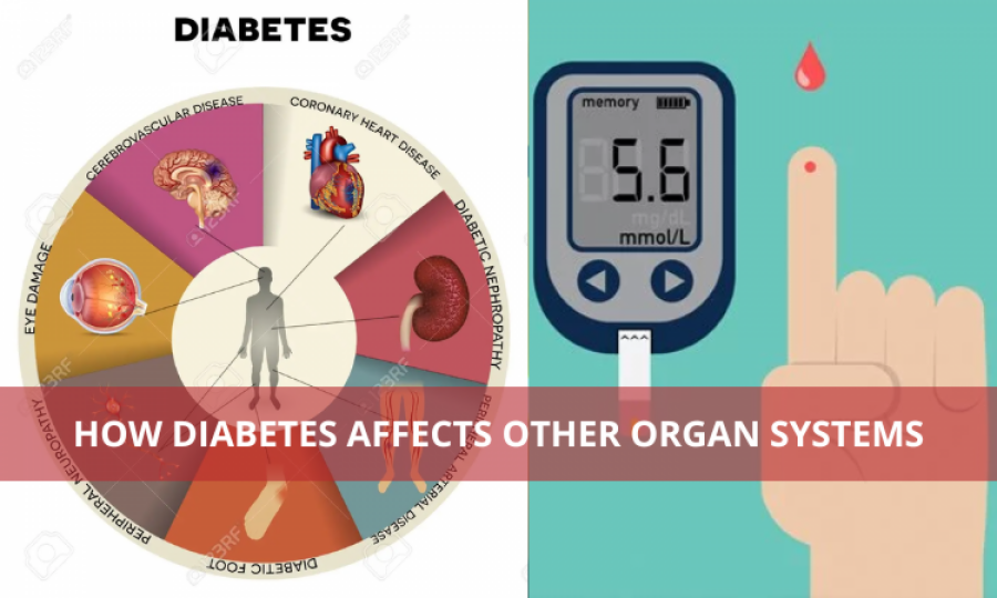 How Diabetes Affects Other Organ Systems