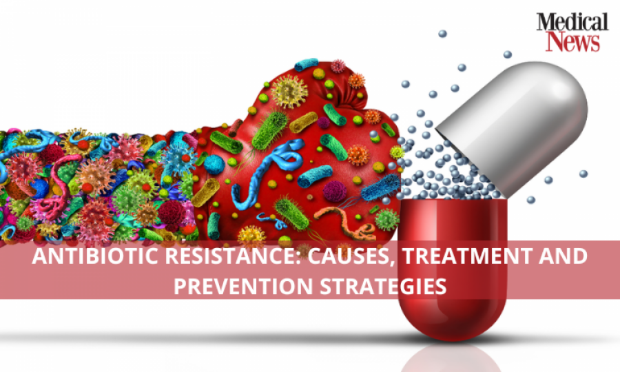 Antibiotic Resistance: Causes, Treatment and Prevention Strategies
