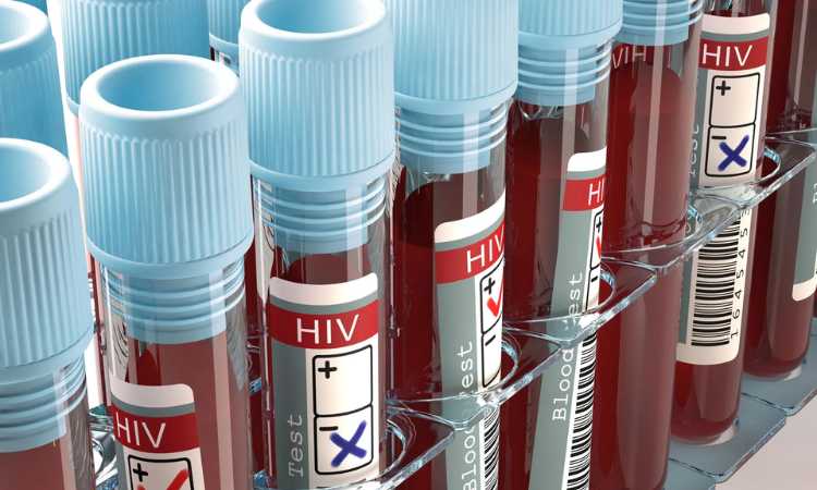 More than 500 people test positive for HIV in Islamabad