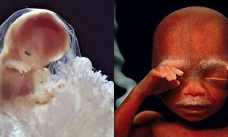 Placenta research puts spotlight on early weeks of human pregnancy 