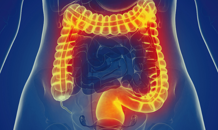 Common immune cells can prevent intestinal healing