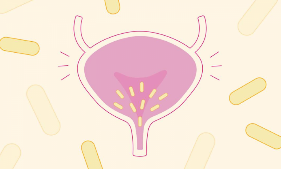 AI can now help diagnose UTIs at earlier stages