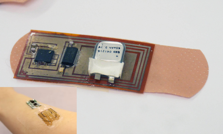 Smart bandage can now monitor and speed up wound repair
