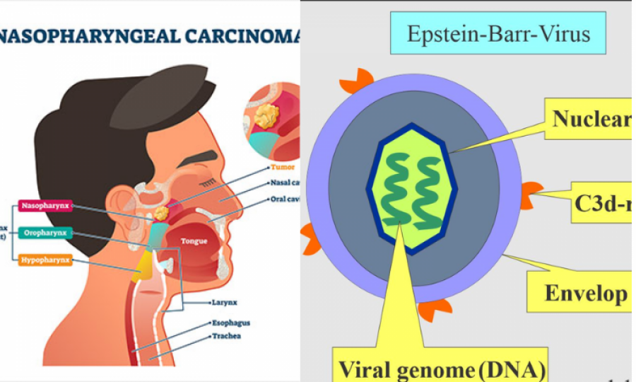 Study: nasopharyngeal carcinoma and Epstein-Barr virus associated immune suppression