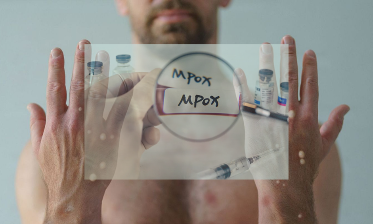 More research required to understand origin and factors affecting Monkeypox: WHO