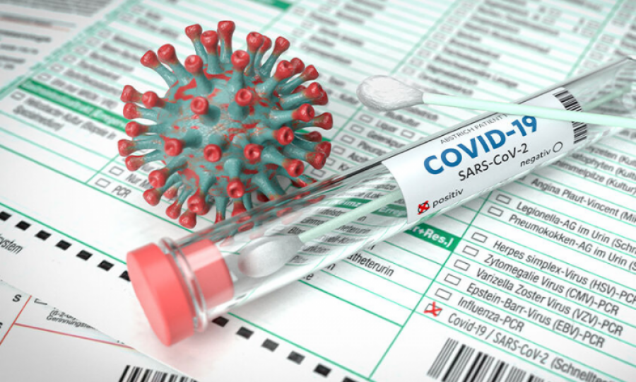 NIH records 31 new cases and one death due to Covid