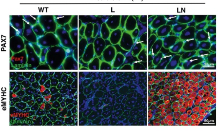 To reverse aging in stem cells, NANOG gene ‘rewires’ metabolic networks