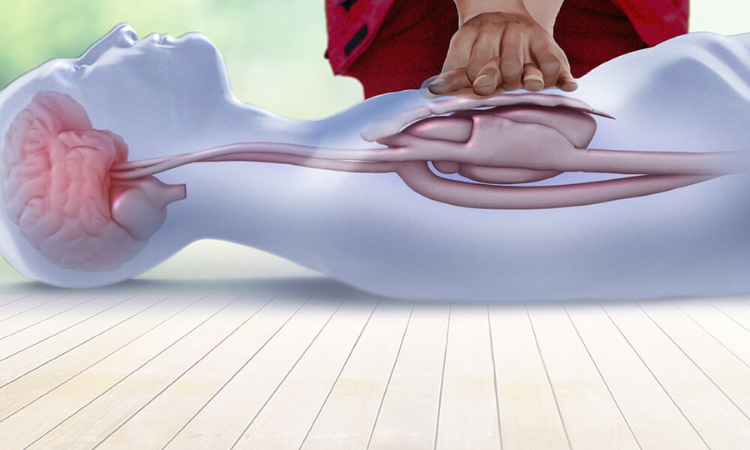 Women get less rapid resuscitation care than men suffering cardiac arrest: study 