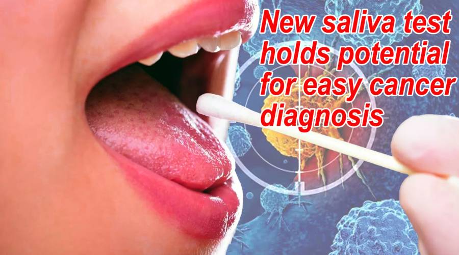 New saliva test holds potential for easy cancer diagnosis 