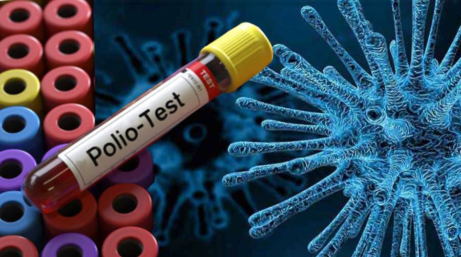 14 environmental samples carry polio virus