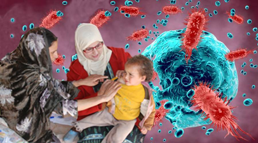Caretaker federal minister for health issues alert to prevent Diphtheria outbreak