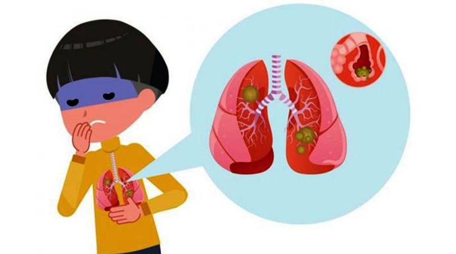 Six more kids succumb to pneumonia in Punjab