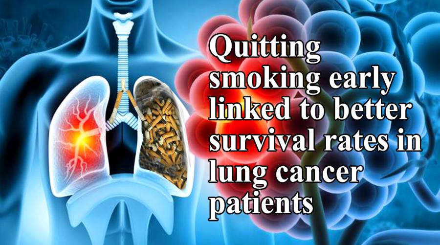 Quitting smoking early linked to better survival rates in lung cancer patients