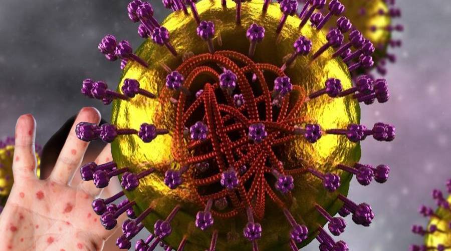 WHO warns of potential global measles outbreak