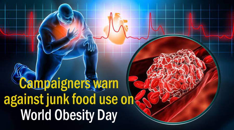 Campaigners warn against junk food use on World Obesity Day 
