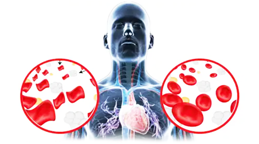Understanding thalassemia and its impact
