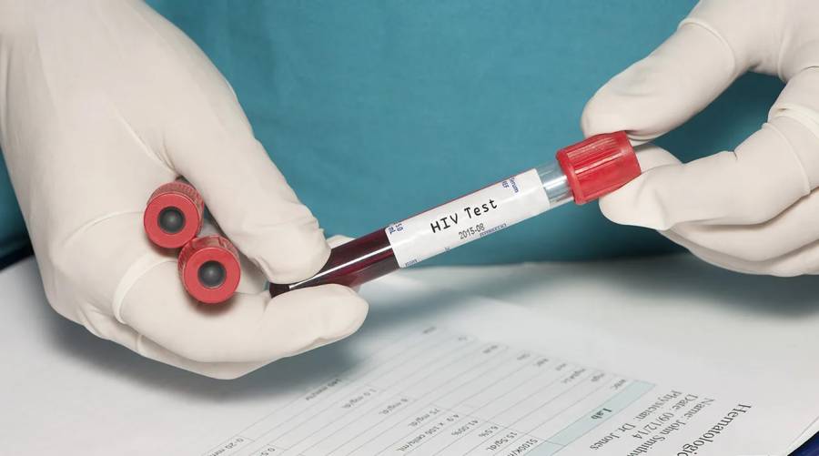 A gloved hand holding a blood sample labeled 'HIV,' symbolizing the recent HIV outbreak in Tunsa Sharif, Punjab.