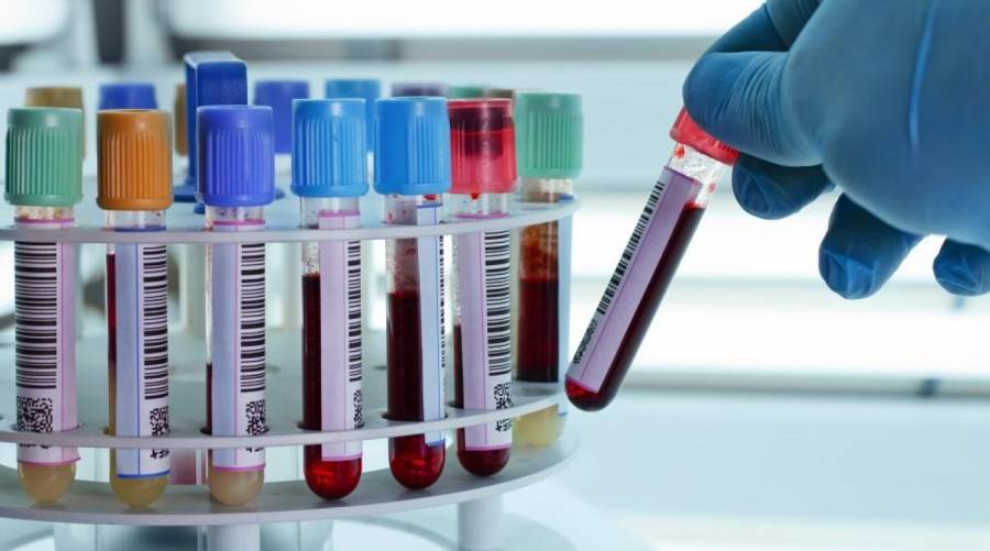 DNA methylation-based test using blood or saliva to assess aging and predict lifespan