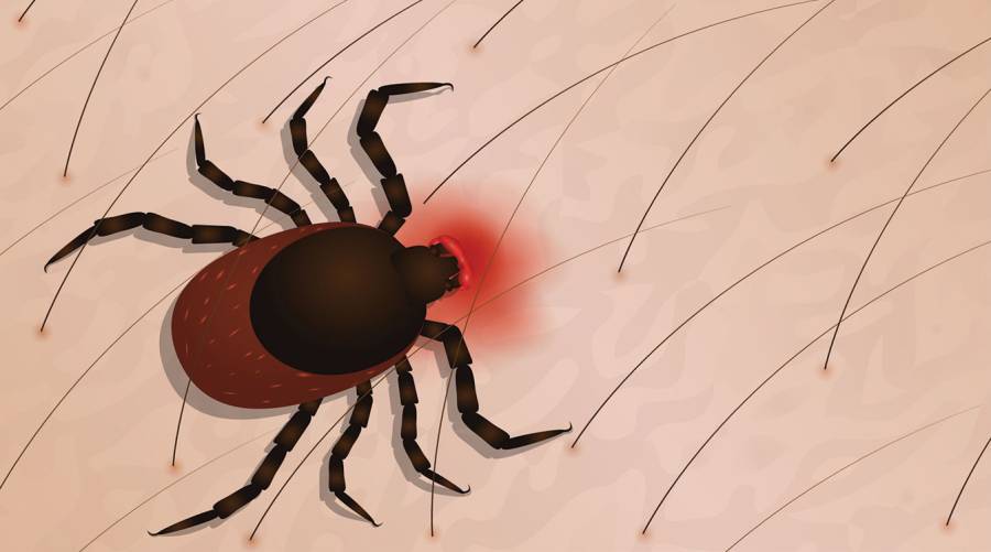 Congo virus medical illustration showing infection symptoms on human body