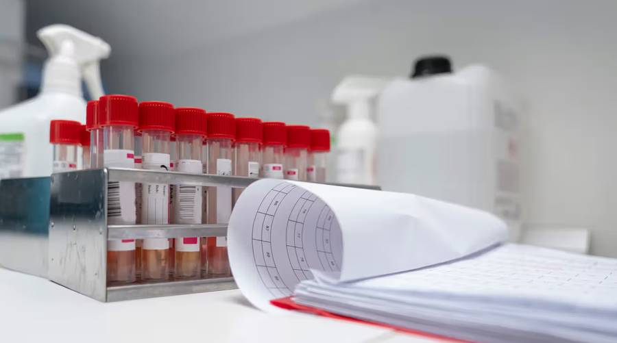 High white blood cell count report being reviewed by a doctor