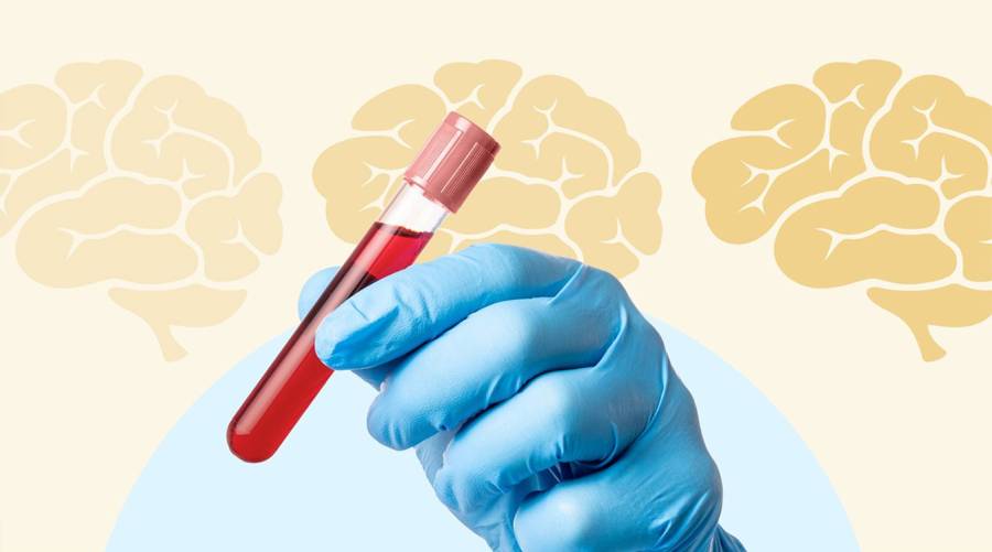 TyG index blood test could predict cognitive decline rate in Alzheimer’s disease