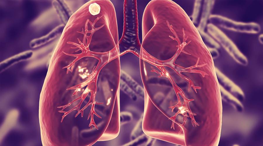 Scientist analyzing lung tissue samples to study immune response to inhaled tuberculosis vaccine