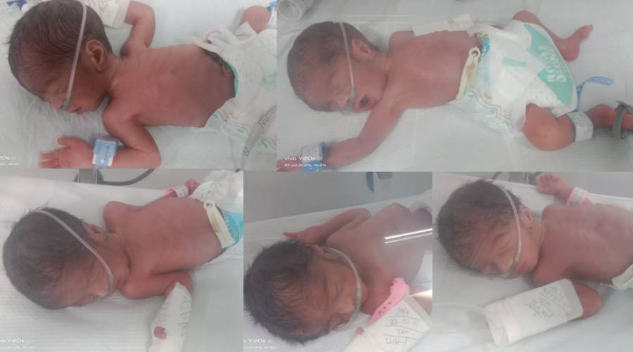 Five premature newborns receiving medical monitoring after emergency C-section in Karachi hospital