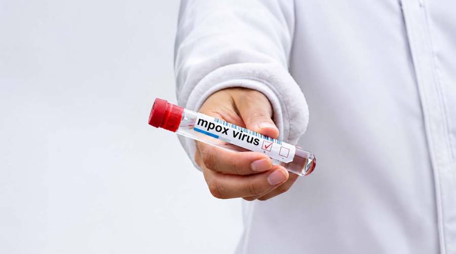 Illustration representing mpox virus and characteristic skin lesions as Sindh reports three newly confirmed cases.